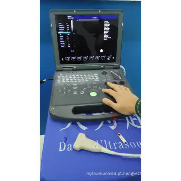 Ultra-som do portátil do equipamento médico 3D &amp; doppler da cor